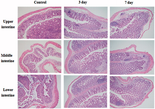 Figure 6. Pathological changes in different colon intestine specimens under light microscope after day 3 and 7 treatment of 5-ASA-GEL.