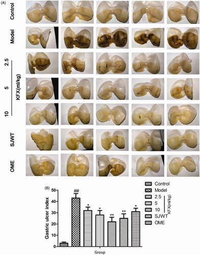 Figure 1. Effects of KFX on the macroscopic morphology and gastric ulcer area of the gastric mucosa in WIRS-treated rats. The data were expressed as the means ± SD (n = 5). ##p < 0.01, compared with the control group; *p < 0.05, **p < 0.01 compared with the model group. KFX: Kangfuxin liquid; SJWT: Sanjiuweitai Granules; OME: Omeprazole.