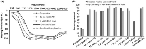 Figure 28. Unaided pure-tone audiometric hearing thresholds at various time points, including at the device failure time point, and three months post-reimplantation (A). Speech perception test results at various time points (B). Graph and histogram created from data given in Thompson et al. [Citation23].