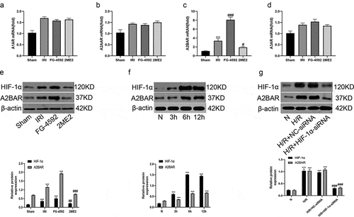 Figure 6. HIF-1α is associated with A2BAR in hepatic IR or H/R injury. (a-d) The expression levels of adenosine receptors (A1, A2A, A2B and A3) in liver tissue of each group by qRT-PCR. (e) Western blot bands and quantitative analysis of HIF-1α and A2BAR expression of liver tissues in each group (β-actin is used as a loading control). (f) Western blot bands and quantitative analysis of HIF-1α and A2BAR expression in BRL-3A cells in different reoxygenation times (0, 3 h,6 h, and 12 h) (β-actin is used as a loading control). (g) Western blot bands and quantitative analysis of HIF-1α and A2BAR expression in cells of each group (β-actin is used as a loading control). All data are shown as mean ± SEM (n = 6 per group). ***P < 0.001 versus the sham or N group; #P < 0.05 and ###P < 0.01 versus the IRI or H/R+ NC-siRNA group