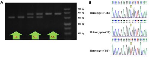 Figure 1 Genotyping and validation results of rs2278426. (A) Electrophoretic results of restriction-enzyme products: CC (one band at 387 bp), CT (two bands at 387 bp and 331 bp), and TT (one band at 331 bp). (B) Results of DNA sequencing: CC, CT, and TT genotypes from top to bottom, and position indicated by arrows was the mutation site.