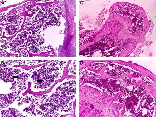 Figure 6 Pathology examination of the bone marrow.Notes: Pathology examination of the bone marrow of the mice treated with Tween® 20-GNPs (A and B) and of the control group (C and D). In (A) and (C), ×4 magnification, and in (B) and (D), ×20 magnification. The black arrows show the megakaryocytes.Abbreviation: GNPs, gold nanoparticles.