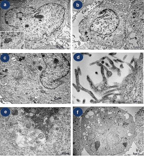 Figure 3. Ultrastructural observations of isolated cells in Beas-2B. (a) type a cell showing an indented nucleus with prominent nucleoli surrounded by a complex cytoplasm that contains prominent rough endoplasmic reticulum, Golgi apparatus, and vacuolation. (b) type B cells show a round shape with scant identifiable organelles. (c-d) abundant microvilli and intermediate filaments. (e) unspecifiable round-shaped feature (f) multilobulated atypical cells showing prominent nucleoli and abundant vacuolation.