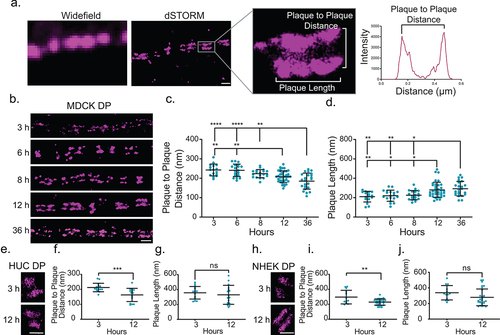 Figure 1. Desmoplakin architecture changes as desmosome mature. (a) Images of desmosomes (MDCK cells labeled for desmoplakin rod/C-terminal domain) illustrating the improved resolution of direct stochastic optical reconstruction microscopy (dSTORM) compared to widefield microscopy. The region of interest shows a single desmosome and illustrates the measurements obtained from dSTORM images. The plaque-to-plaque distance is quantified as illustrated in the plot of fluorescence intensity as a function of distance for a line scan through the desmosome. Scale bar = 0.5 μm. (b-d) MDCK cells were stained for the desmoplakin rod/C-term junction following Ca2+ switch for 3, 6, 8, 12, and 36 h as indicated. (b) Representative dSTORM images of cell-cell borders at each timepoint. (c) Plaque-to-plaque distance and (d) plaque length at each timepoint (mean ± SD; datapoints are individual desmosomes). (e) HUC dSTORM images at 3 and 12 h, (f) plaque-to-plaque distance, and (g) plaque length at each timepoint (mean ± SD). (e) NHEK dSTORM images at 3 and 12 h, (f) plaque-to-plaque distance, and (g) plaque length at each timepoint (mean ± SD). (b, e and h) Scale bars = 1 μm. (ns, not significant, * P ≤ .05, ** P ≤ .01, *** P ≤ .001, and **** P ≤ .0001 by (c, d) ANOVA with post hoc Tukey’s test or f, g, i and j) Student’s t-test. (c and d) (MDCK 3 h n = 16, 6 h n = 19, 8 h n = 19, 12 h n = 37, and 36 h n = 23) and (f and g) (HUC 3 h n = 16 and 12 h n = 16); and (i and j) (NHEK 3 h n = 13 and 6 h n = 31). Experiments were performed in triplicate.