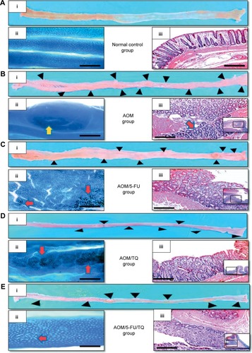 Figure 1 Representative photos of macroscopic and microscopic appearance of colorectal mucosa.