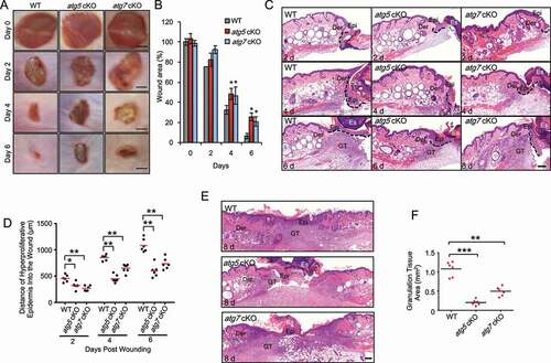 Figure 1. Epidermal autophagy deficiency inhibits wound healing. (A) Macroscopy view of wound healing on days 0, 2, 4 and 6 in WT, atg5 cKO, and atg7 cKO mice. Scale bar: 1 mm. (B) Quantification of A. (C and E) Wound healing as monitored by histological staining of skin sections at the wound edges at 2, 4, 6 and 8 d after injury in WT, atg5 cKO and atg7 cKO mice. Epi: Epidermis; Der: Dermis; Es: Eschar. GT: Granulation Tissue. Black dotted lines denote dermal-epidermal boundaries (C). Scale bar: 200 μm. (D) Quantification of the length of hyper-proliferative epidermis. (F) Quantification of the granulation tissue areas. All bars represent mean ± SD (n = 6). *, P < 0.05; *, P < 0.01; ***, P < 0.001; compared with WT mice (B) or between comparison groups (D, F); Student’s t-test