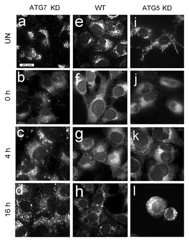 Figure 7. Effects of WST11 PDT on LTR labeling. WT, ATG5 KD and ATG7 KD cultures were left untreated (a, e and i) or incubated with 1 µM WST11 for 16 h prior to being irradiated (405 mJ/cm2), and labeled with LTR immediately (b ,f and j), 4 h (c, g and k) or 16 h (d, h and l) after irradiation. Bar in (a): 20 μm.