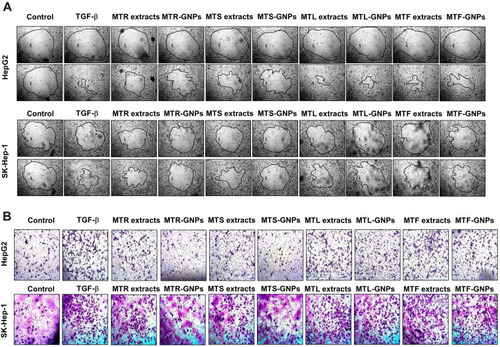 Figure 5 Anti-migration and -invasion effects of MTR-, MTS-, MTL-, and MTF-GNPs.Notes: (A) Cell migration was detected in HepG2 and SK-Hep-1 cells using the Radius™ 24-Well Cell Migration Assay kit. (B) Cell invasion was measured with the CytoSelect™ Cell Migration and Invasion assay kit. Control is non-treated group.Abbreviations: MTR-, MTS-, MTL-, and MTF-GNPs, Maclura tricuspidata root-, stem-, leaf-, and fruit-extract-gold nanoparticles, respectively; TGF-β, transforming growth factor-beta.