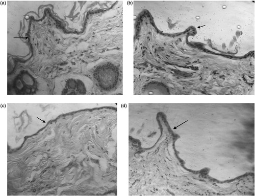 Figure 5. Representative micrographs of rabbit skin after topical application of MF (a), MpC (b), PE (c), and ethanol (d) under occluded conditions for 96 h (arrows indicating thickness of epidermis).