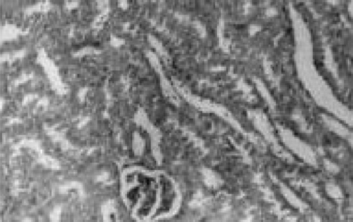 Figure 4. Normal + chloroquine. Cloudy swelling of tubules with hyaline casts in tubular lumen. HX10.