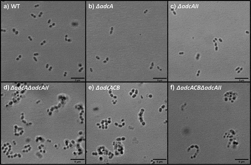 Figure 5. Bright-field microscopic images of E. faecalis and its indicated mutants. Images shown are representative of 10 images that are acquired from one biological sample from each strain grown in BHI, respectively, and imaged at 100x magnification. Black bars represent five microns in length.