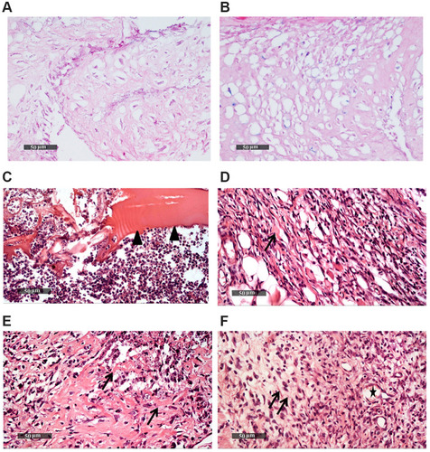 Figure 4 H&E staining showing the in vitro chondrogenic differentiation of BMSCs (A), and of hDPSCs (B) in the NC-CS/GP-21 hydrogel. H&E staining for in vivo tissue samples obtained at 7 days showing subcutaneous eosinophilic-injected biomaterial (arrow head) surrounded by abundant polymorphonuclear inflammatory cells infiltrates (C), significant fibroblastic activity and newly formed collagen fibers (arrow) (D). At 14 days, there was a significant reduction in the inflammatory reaction with reduced mononuclear inflammatory cells infiltration with higher fibroblastic activity and more collagen fibers deposition (arrow) (E). At 21 days, samples showed granulation tissue with higher fibroblastic activity. More collagen fiber deposition (arrow) was detected accompanied by dilated and congested subcutaneous blood vessels (star) (F).