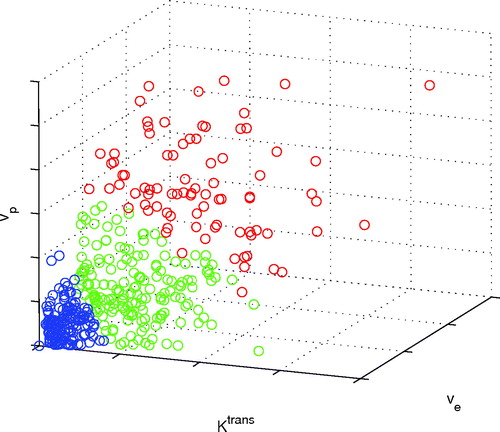 Figure 1.  Voxels of a 200 mm3 KHT tumour divided into three regions with different DCE-MRI model parameter characteristics by the K-means algorithm.