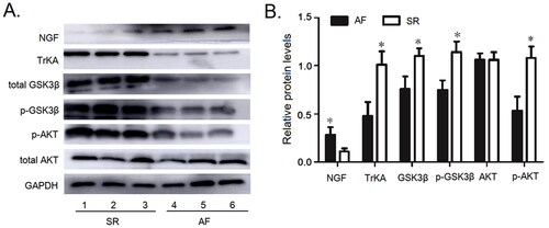 Figure 5. The protein expressions of NGF, TrKA, GSK3β, p-S9 GSK3β, AKT and p-S473 AKT were detected in the peripheral blood lymphocytes. (A) The protein expressions of NGF, TrKA, GSK3β, p-S9 GSK3β, AKT and p-S473 AKT in the peripheral blood lymphocytes. (B) Quantitative assessement of the protein expressions of NGF, TrKA, GSK3β, p-S9 GSK3β, AKT and p-S473 AKT in the Peripheral Blood Lymphocytes in AF patients compared to that in SR patients. *p<.05 vs. AF. AF: atrial fibrillation; SR: sinus rhythm; Akt: protein kinase B; GSK3β: glycogen synthase kinase 3β; NGF: nerve growth factor.