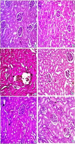 Fig. 2 Microphotograph of rat kidney (hematoxylin and eosin stain) (a). Representative section of renal from the control group showing normal histology, (b) DMSO+Olive oil group, (c) CCl4 group, (d) silymarin+CCl4 group, (e) MFC+CCl4 group, (f) EFC+CCl4 group, (g) HFC+CCl4 group, () glomerular atrophy, ( ) vascular congestions around the tubules, () alterations in Bowmen's space, (▴) tubular dilations, () distorted renal corpuscles.