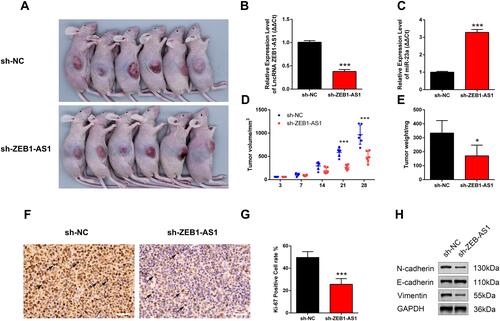 Figure 5 ZEB1-AS1 knockdown inhibited OSCC progression. (A) A gross look of xenograft tumors. (B, C) The relative expression of ZEB1-AS1 and miR-23a in OSCC xenograft tissues. (D) Tumor volumes were examined at days 3, 7, 14, 21, and 28 (n=6). (E) Tumor weights measured at day 28 (n=6). (F, G) Tumor cell proliferation was detected with IHC using an antibody against Ki-67. (H) The protein levels of vimentin, N-cadherin, and E-cadherin in OSCC xenograft tissues. Data are presented as the means ± SD. *, P < 0.05; ***, P < 0.0001. Scale bar=50μm.