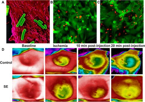 Figure 6 Application of microalgae in ischemic heart disease. (A) SEM image of cyanobacteria and cardiomyocytes. (B and C) Dead and live cell staining for cardiomyocytes. (D) Thermal images of rat hearts in different groups recorded before and after treatment. From Cohen JE, Goldstone AB, Paulsen MJ, et al. An innovative biologic system for photon-powered myocardium in the ischemic heart. Sci Adv.2017;3(6):e1603078. © The Authors, some rights reserved; exclusive licensee AAAS. Distributed under a CCBY-NC 4.0 license https://creativecommons.org/licenses/by/4.0/”. Reprinted with permission from AAAS.Citation14