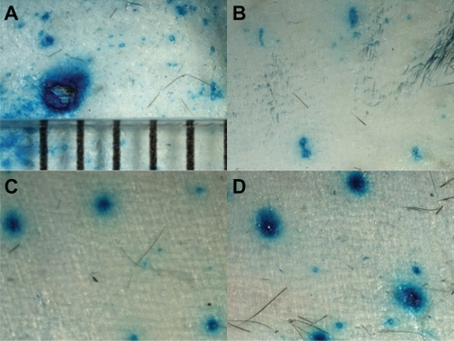 Figure 2 Magnified microscopic view of mouse skin after treatment with a 21 gauge hypodermic needle (A) or microneedle rollers with different size microneedles, ie, small (B), medium (C), and large (D). The skin was stained with methylene blue solution.Notes: The distance between the bars in A is 1 mm; all photos were taken under the same magnification.