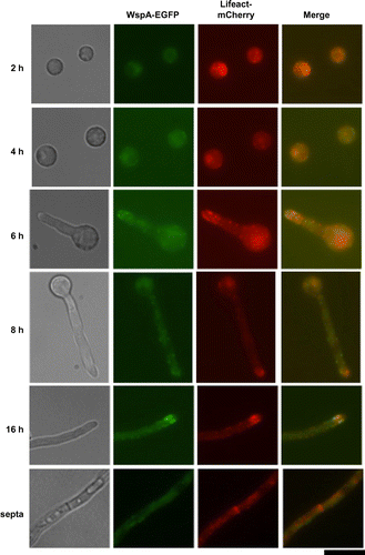 Fig. 5. Co-localization of WspA and F-actin in A. nidulans.