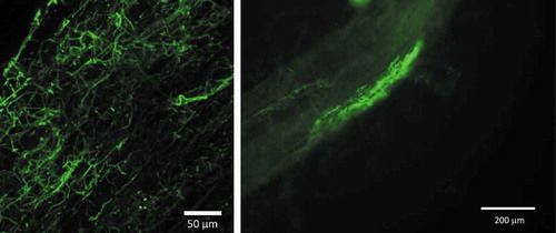 Figure 6. Hyphae of Cadophora sp. visualised in tomato roots using specific FISH probes labelled with Alexa Fluor 488. Photographs were taken using a Leica SP8 confocal laser scanning microscope (left) and a Nikon Eclipse 80i fluorescence microscope (right).