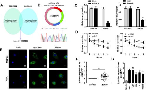 Figure 1 circCSPP1 expression is upregulated in liver cancer. (A) Bioinformatics analysis based on two datasets from the GEO database was carried out. Venn analysis was performed to identify the dysregulated genes in both datasets. (B) Sanger sequence was performed to confirm the existence of circCSPP1. (C) To identify the presence of circCSPP1, the levels of linear CSPP1 mRNA and circCSPP1 were evaluated following treatment of the samples with RNase R (n=3). (D) RT-qPCR analysis of CSPP1mRNA and circCSPP1 in cardiomyocytes following treatment with actinomycin D for 0, 6, 12 and 24 h, respectively (n=3). (E) FISH experiments were performed to detect the location of circCSPP1 (n=3). qPCR was performed to evaluate the expression levels of circNELL2 in liver cancer (F) tissues (n=55) and (G) cell lines (n=3) including HepG2, Huh7, 97L, LM3, and Hep3B. **p<0.01 vs mock, mRNA, normal or THLE-2 groups.