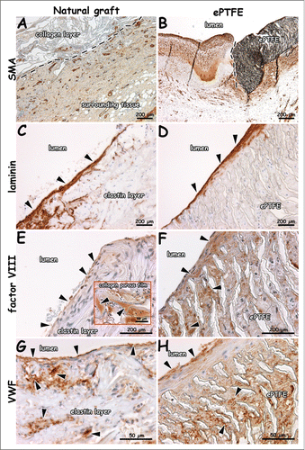 Figure 7. Immunohistochemical images of explants 1 week after surgery (patent lumens). Staining for smooth muscle actin (A, B), laminin (C, D), factor VIII (E, F) and VWF (G, H). Surrounding tissue has invaded the outer collagen layer of the natural graft (A). Endothelial cells on a laminin-positive layer (C, D). Endothelial cells positive for VWF and factor VIII (E-H). VWF-rich depots in the collagen porous film (insert E). Arrows indicate positive staining (C-E), and dotted lines indicate boundary between collagen scaffold and surrounding tissue (A), and anastomosis (B, distal). Bars present 200 µm (A-F) and 50 µm (G, H, and insert of E).
