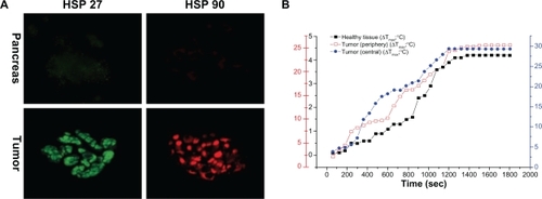 Figure 8 Thermal response to HSA-MWCNT-mediated photothermal therapy. A) The top row of images depicts basal level of expression of HSP27 (green) and HSP90 (red) in healthy, surrounding tissue. The lower row of images depict HSP expression in tumor sections. B) 3 Y-plot chart of time-temperature curves obtained from the healthy and malign tissue, with use of the thermistors.Abbreviation: HSP, heat shock protein.