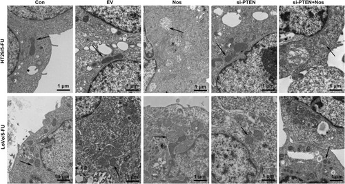 Figure 2 PTEN interference alleviated noscapine-induced mitochondrial damage in HT29/5-FU and LoVo/5-FU cells. Mitochondrial morphology (arrows) was observed using electron microscopy, scale bar = 1 μm.