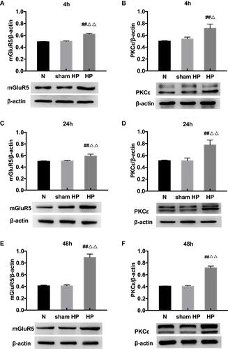 Figure 2 (A–F) Western blot shows the expression of mGluR5 and PKCε in the L4-6 DRGs extracts from hyperalgesic priming rats at 4 h (A, B), 24 h (C, D), 48 h (E, F) after the 2nd injection. Data are presented as the mean ± SEM, n = 6; ##P < 0.01 vs N group; ΔΔP < 0.01, ΔP < 0.05 vs sham HP group.