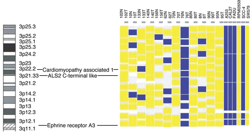 Figure 2 LOH determined by SNP analysis in the human HNSCC samples and cell lines. SNP analysis was performed using Affymetrix 10K SNP arrays and dChip software. Blue color represents areas with LOH, yellow color indicates areas with allelic retention, while white and gray colors mean ‘not informative’.