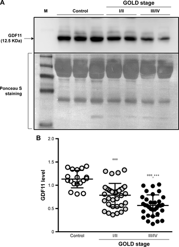 Figure S1 Levels of GDF11 in plasma.Notes: Plasma was obtained from the control subjects, GOLD stage I/II and GOLD stage III/IV COPD patients. The levels of plasma GDF11 were investigated by immunoblotting (A). Ponceau S staining was used to evaluate the amounts of protein. The GDF11 levels were calculated by measuring the intensity of the bands (B). Open circles: control; closed circles (gray): GOLD stage I/II; closed circles (black): GOLD stage III/IV. Results are expressed mean ± SD. Data were analyzed with one-way ANOVA followed by Tukey’s test. ***p < 0.001 compared with control; +++p < 0.001 compared with GOLD stage I/II.Abbreviations: ANOVA, analysis of variance; GDF11, growth differentiation factor 11; GOLD, Global Initiative for Chronic Obstructive Lung Disease; M, molecular weight marker.