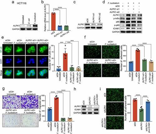 Figure 5. ALPK1 mediates NF-κB-dependent responses to F. nucleatum infection. (a) Western blot analysis of ALPK1 in HCT116 cells treated with F. nucleatum, E. coli or PBS control. (b-c) Quantitative RT-PCR (b) and Western blot analysis (c) of ALPK1 were performed in HCT116 cells transfected with two siRNAs targeting ALPK1 or control siRNAs. (d) HCT116 cells transfected with the indicated siRNAs were co-cultured with F. nucleatum or PBS control. Western blot analysis of ALPK1, phosphor-IκBα, p65, phospho-p65 and ICAM1 were performed. (e) The distribution of NF-κB p65 in the indicated cells was measured by immunofluorescence assay. Scale bar, 20 μm. (f-g) HCT116 cells transfected with the indicated siRNAs were co-cultured with F. nucleatum or PBS control. Adhesion assay (f) and migration assay (g) were performed. The migrated cells were observed at 18 hours. Scale bar, 100 μm. (h-i) ALPK1-depleted HCT116 cells transfected with the indicated plasmids were applied for Western blot analysis (h) and adhesion assay (i). Scale bar, 100 μm. Data are shown as mean ± SD. *** P < .001, **** P < .0001, by Student’s t test.