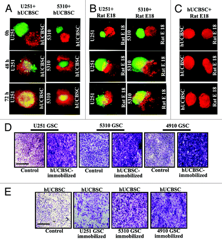 Figure 3. Cord blood stem cells inhibit glioma cell migration and invasion. U251 and 5310 glioma spheroids labeled with fluorescent Cell TrackerTM Green dye were confronted with hUCBSC and fetal rat brain aggregates labeled with fluorescent CellTrackerTM Red dye. Progressive destruction of glioma spheroids by hUCBSC spheroids (A) and fetal brain aggregates by glioma tumor spheroids (B) were observed. hUCBSC spheroids remained away from fetal brain aggregates (C) when confronted for 72 h. (D) U251, 5310 and 4910 GSC were allowed to invade through the Matrigel for 24 h. (E) In another experiment, either hUCBSC or glioma cells were immobilized or their counterparts were allowed to pass through the Matrigel. After 24 h, migrated cells in all of the treatments were counted under the microscope.