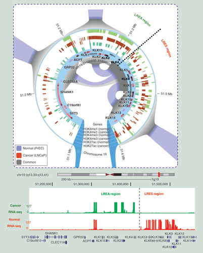 Figure 2.  Changes in long-range chromatin interactions in cancer results in aberrant long-range activation and repression of genes.Example of chromatin interactions visualized in the Rondo interactive analysis tool [Citation64]. Anchor points of differential interactions are visualized simultaneously with ChIP-seq (H3K27ac, H3K4me1, H3K4me3) and RefSeq genes inferring functionality (both active and repressive) of interactions. Hi-C data obtained from [Citation53] are presented at 100 kb resolution. Differential chromatin interactions in prostate cancer cells lymph node carcinoma of the prostate (LNCaP) and normal prostate cells primary prostate epithelial cells (PrEC) at an example region of long-range epigenetic activation and adjacent long-range epigenetic silencing are shown. Gray indicates shared interactions in normal and cancer cells. Blue indicates interactions that are lost in cancer. RNA-seq gene expression demonstrates that genes located at long-range epigenetic activation/long-range epigenetic silencing differential interactions have altered expression in cancer.