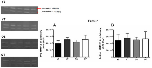 Figure 3 Optical densitometry of zymography bands of MMP-2 in the right femur. Activity was expressed in arbitrary units. Values are presented as means ± SD. (A) Pro-MMP-2 (~68 kDa). (B) Active MMP-2 (62 kDa). The experimental groups were: young sedentary (YS), young trained (YT), old sedentary (OS), and old trained (OT). No statistically significant differences between groups, p>0.05 (n=5 per group).