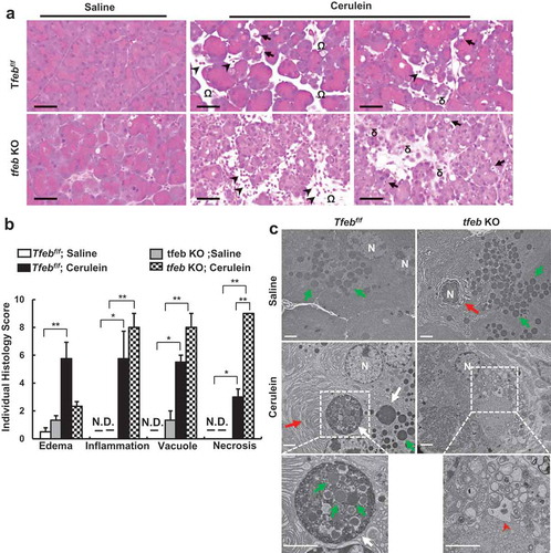 Figure 6. Acinar cell-specific tfeb knockout mice exacerbate cerulein-induced pancreatitis. BAC-Ela-Cre−; Tfebf/f (Tfebf/f) and BAC-Ela-Cre+; Tfebf/f (tfeb KO) mice were injected with tamoxifen (75 mg/kg) once a day for consecutive 5 days. Five days later after the last injection, these mice were further treated with 7-hourly injections of cerulein (20 μg/kg). (a) Representative images of H&E staining are shown. Arrows denote for acinar cells with vacuoles; arrow heads denote for infiltrated inflammatory cells, omega denotes for edema and delta denotes for necrosis. Bar: 50 μm. (b) Individual histology score was graded and data are mean ± SE (n = 3–4). *p < 0.05; **p < 0.01; One-way ANOVA analysis. (c) Representative EM images of pancreatic tissues are shown. Lower panels are enlarged photographs from the boxed areas. White arrows: autolysosome, green arrows: ZG; red arrows: ER; arrow heads: disrupted organelles. Bar: 2 µm.
