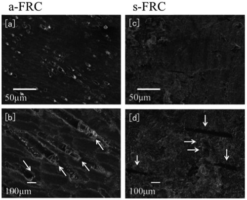 Figure 5. Scanning electron micro-morphologies show the prosthetic surfaces of crown restorations made from single-structure FRCs. The surfaces of a-FRC with magnifications of ×100 and of ×500 are shown in (a) and (b), whereas those of s-FRC with magnifications of ×100 and ×500 are presented in (c) and (d), respectively. Sections of chopped fiberglass were observed on the surface of a-FRC as indicated by arrows in (b), whereas parallel oriented fibers were present on the surface of s-FRC as indicated by arrows in (d). For the surface of s-FRC, the crushed edges of the fiberglass and the lateral side of the oriented fiberglass are indicated by horizontal arrows and vertical arrows, respectively, in (d). Abbreviation: FRC: fiber-reinforced composite.