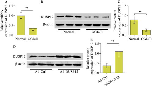 Figure 1. DUSP12 expression in OGD/R-exposed neurons and overexpression of DUSP12 by adenovirus. The expression of DUSP12 in HT22 neurons post-OGD/R was examined by (A) qRT-PCR and (B, C) Western blotting. (D, E) HT22 neurons were infected with Ad-DUSP12 or Ad-Ctrl for 48 h and DUSP12 expression was detected by Western blotting. n = 3. **p < 0.01. Statistical differences were determined using Student’s t-test.
