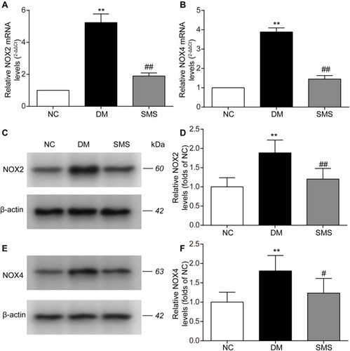 Figure 4 SMS blocks NOX activation in STZ-induced DM rats. (A and B) Real-time quantitative polymerase chain reaction and quantitative analysis of NOX2 and NOX4 mRNA levels in heart tissues. (C–F) Representative Western blot and quantitative analyses of NOX2 and NOX4 protein levels in heart tissues. β-actin was used as the internal control. Results are presented as means ± standard deviations. **p < 0.01 vs the NC group; # p < 0.05 vs the DM group, and ## p < 0.01 vs the DM group (n = 6 rats per group).