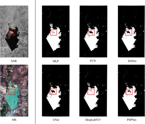 Figure 11. Extraction results of Venezuela. The red boxes show the most obvious differences in the extraction results between models.