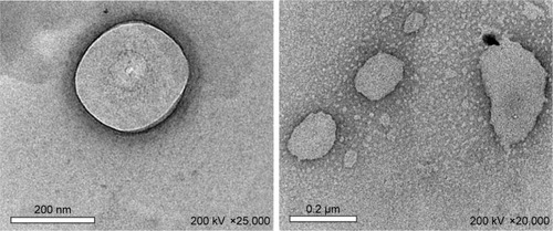 Figure 2 Transmission electron microscopy image for pomegranate extract solid lipid nanoparticles obtained from batch F5.