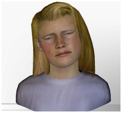 Figure 1 A young, Caucasian, female virtual human showing a high pain expression.