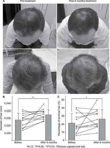 Figure 4 Results of the pretreatment and post 6 months of treatment.