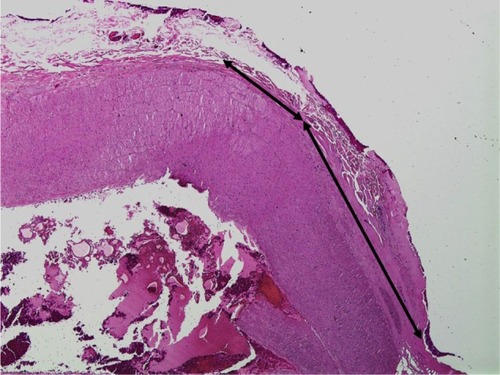 Figure 6 Hematoxylin and eosin staining of goat carotid artery sealed with Harmonic ACE®+7 at 40× magnification.