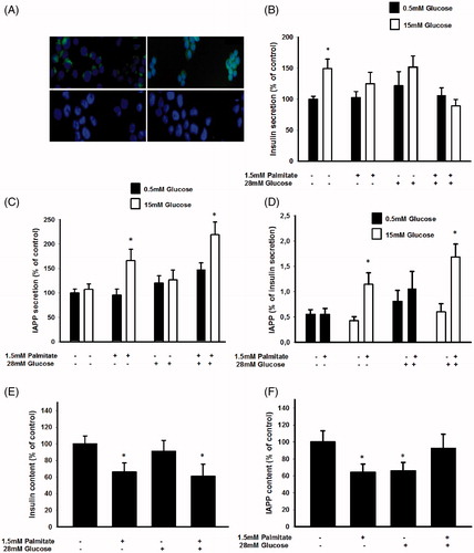 Figure 1. Long-term exposure of EndoC-βH1 cells to palmitate increases glucose-induced IAPP secretion and the IAPP to insulin ratio. (A) EndoC-βH1 cells were immunostained for insulin (upper left), IAPP (upper right), glucagon (lower left), and somatostatin (lower right), as well as with DAPI (blue). The cells were then photographed in a Nikon fluorescence microscope using a 40× lens. (B) EndoC-βH1 cells were cultured for 3 days in 5.6 mmol/L glucose +2% BSA with or without 1.5 mmol/L sodium palmitate and 28 mmol/L glucose. The secretion of insulin was analyzed by incubating the cells at 0.5 or 15 mmol/L glucose in a KRBH buffer for 2 h. (C) Cells cultured for 3 days as given in (B) and then incubated for 2 h in a KRBH buffer were used for IAPP secretion experiments. (D) The percentage of secreted IAPP in relation to insulin was calculated from results obtained in (B) and (C). (E) Cells cultured for 3 days as given in (B) were used for insulin content analysis. (F) Cells cultured for 3 days as given in (B) were used for IAPP content analysis. All results are means of duplicates and are expressed as percent of control. Bars represent means ± SEM for 3–4 independent experiments.