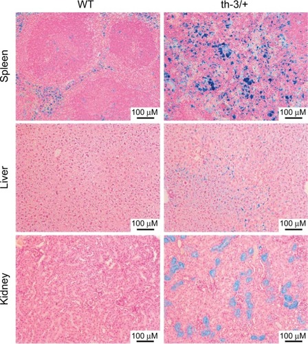 Figure 3 Systemic iron accumulation in the Hbbth-3/+ β-thalassemic mouse.