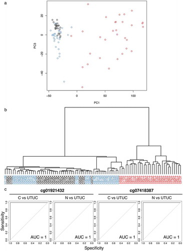 Figure 1. DNA methylation profiling of tissue samples in the initial cohort. (a) Principal component analysis based on the results of the Infinium assay. The DNA methylation profile of non-cancerous urothelium (N, n = 31, blue) from patients with upper urinary tract urothelial carcinoma (UTUC) tended to differ from that of normal control urothelium (C, n = 26, black). Furthermore, the DNA methylation profile of the corresponding UTUC (n = 31, red) clearly differed from those of both C and N samples. (b) Unsupervised hierarchical clustering (Ward’s linkage using Euclidean distances). The distinct difference of the DNA methylation profile of UTUC (red) from that of C (black) or N (blue) samples is again confirmed. (c) Representative results of receiver operating characteristic curve analysis for candidate marker CpG sites identified using the procedures described in the Results section. The area under the curve values for Infinium probes cg01921432 and cg07418387 for discrimination of UTUC from C and those of the same probes for discrimination of UTUC from N are all 1