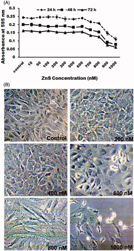 Figure 3. Cytotoxic effect of ZnS-NPs on MRPE cells. (A) MRPE cells were treated with various concentrations of ZnS-NPs and cell viability was measured after 24, 48 and 72 h. (B) MRPE cells were treated with various concentrations of ZnS-NPs and morphological changes were observed by phase contrast microscope. Higher doses of ZnS-NPs-induced (800 nM and 1000 nM) morphological alteration at 24 h.