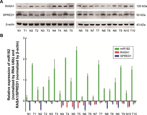 Figure 3 The reverse correlation of miR182 and RASA1 or SPRED1 protein levels.