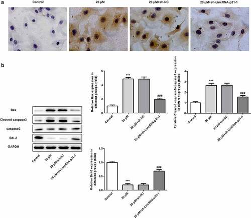 Figure 4. Cisatracurium promotes apoptosis of OVCAR-3 cells by activating lincRNA-p21. (a) Cell apoptosis were determined by TUNEL staining. (b) The expression levels of apoptosis-related proteins (Bax, Bcl-2, caspase3 and Cleaved caspase3) were determined by WB. ***p < 0.001 vs. Control; ###p < 0.001 vs. 20 μM+sh-NC. n = 3